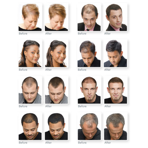 XFUSION HAIR BUILDING FIBERS 28GM